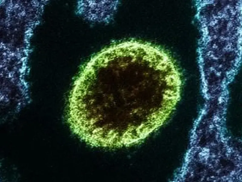 Ministérios e países aceleram alerta por surto do vírus Nipah na Índia