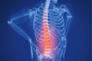 Transplante inédito de medula espinhal humana é realizado na Rússia