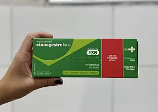 Anvisa amplia validade do Implanon para cinco anos e autoriza uso após o parto